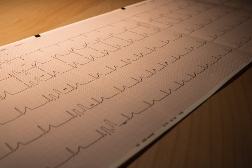 Graph showing prevalence of MINOCA heart attacks